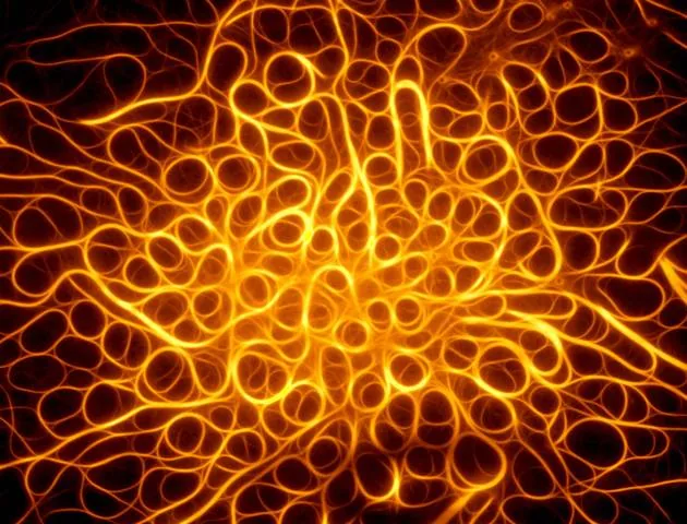 "actin bundles" image