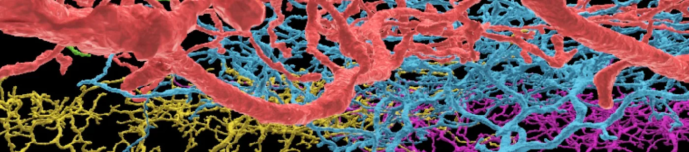 neuron branches, eyewire, 